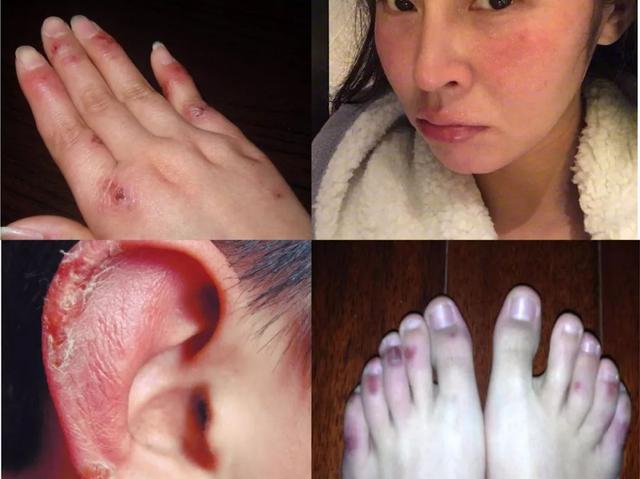 能不能用蛇油膏当身体乳