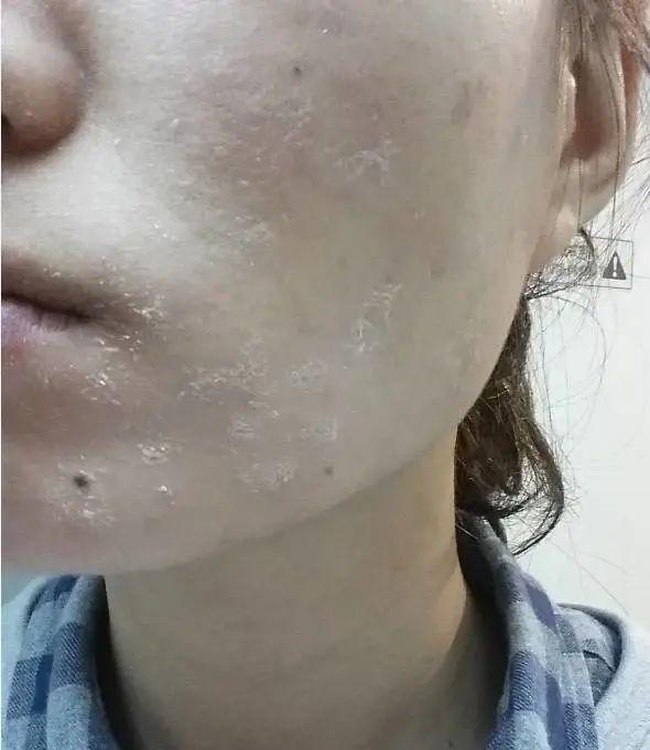 能不能用蛇油膏当身体乳