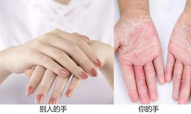 能不能用蛇油膏当身体乳