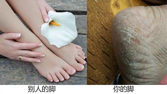 能不能用蛇油膏当身体乳