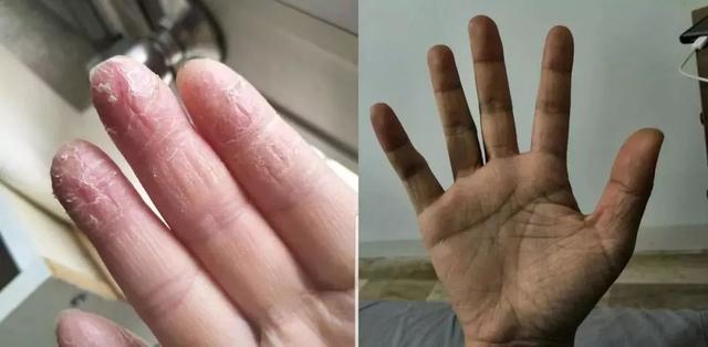 能不能用蛇油膏当身体乳