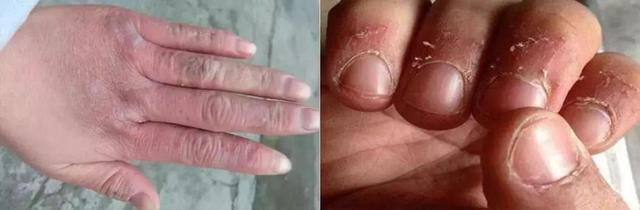 能不能用蛇油膏当身体乳
