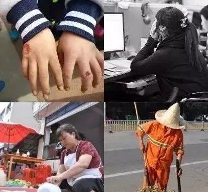能不能用蛇油膏当身体乳