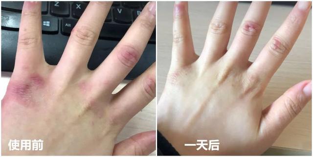 能不能用蛇油膏当身体乳