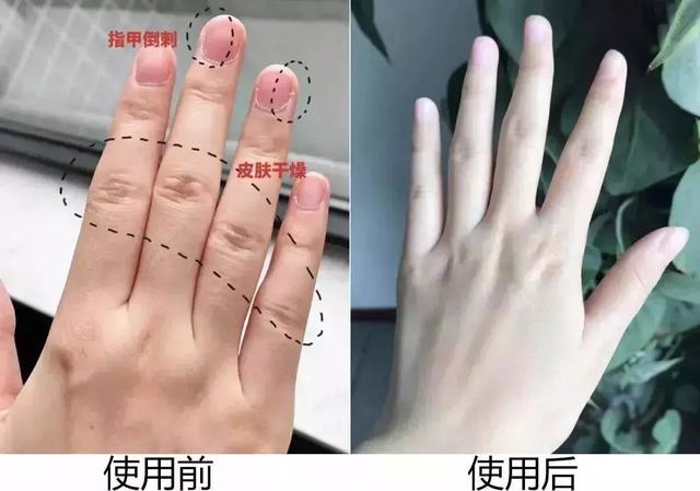 能不能用蛇油膏当身体乳
