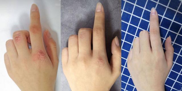 能不能用蛇油膏当身体乳