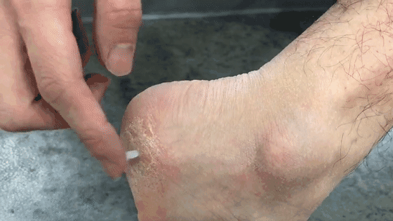 能不能用蛇油膏当身体乳