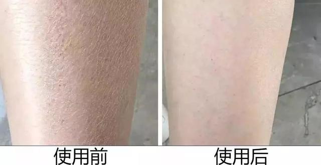 能不能用蛇油膏当身体乳