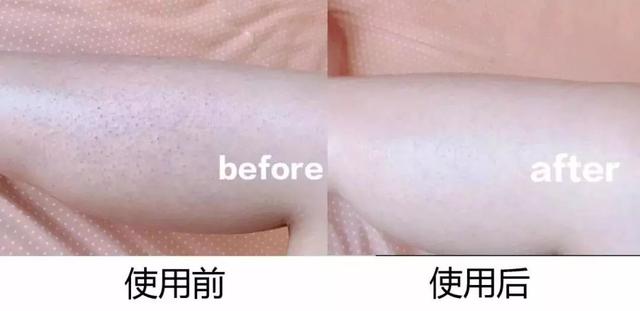 能不能用蛇油膏当身体乳