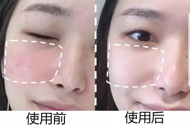 能不能用蛇油膏当身体乳