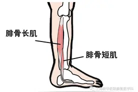 常常腿酸腿胀，或因走路姿势不对！学会走路，可健脑、健身图片