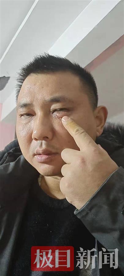 新疆疫情车贷逾期，新疆疫情车贷逾期怎么办 配图05