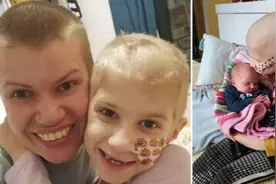 女孩背痛患罕见癌症，妈妈剃光头陪其抗癌图片