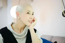 日本女子患怪病被歧视30多年！抑郁症、剃光头却一路开挂逆袭成绝美模特图片
