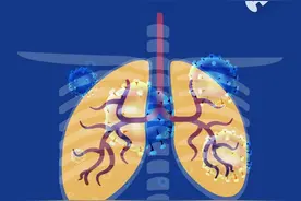 国产第一款、全球第二款13价肺炎疫苗来了！一图读懂知识点图片