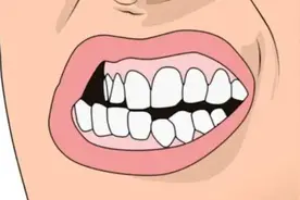 孩子磨牙是因为肚子里有寄生虫？图片