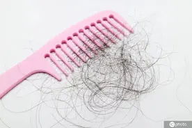 用生姜涂头皮能生发？很多人都照做了！可能会适得其反……图片