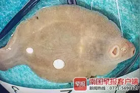 广西一女子肝脏被吃掉三分之一，医生：“元凶”极为少见图片