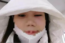 满哥帮忙 | 女子注射玻尿酸后肿成大小眼，涉事机构曾被陈乔恩起诉判赔图片