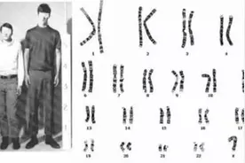 “第三性别”男子染色体多了一条Y，将过怎样的人生？图片