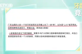 牙龈长包竟是“癌”？改掉这几个不良习惯 现在还不算晚图片