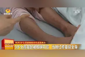 女孩被蜘蛛咬伤，全身红肿起疹吓坏家长图片