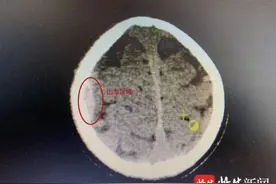 金毛犬闯大祸了，淮安一四岁女童被撞颅内出血图片