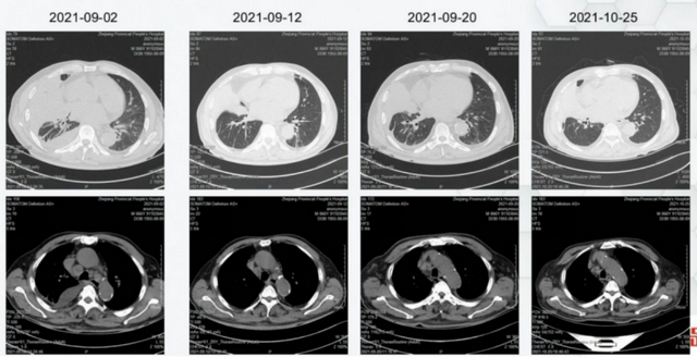 全身鸡皮肤该如何治