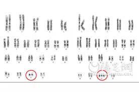 世界唐氏综合征日 3分钟教你看懂唐筛报告图片