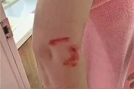 交房才两年！精装房浴室玻璃频爆裂，有业主被划伤，开发商却称已过质保期图片