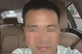 苍南吴先生的烦恼：本想去掉额头“川字纹”，结果成了这样图片