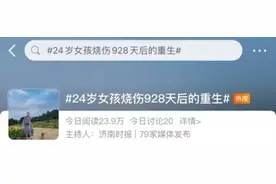 90后女孩烧伤做12次手术，却有人假冒她带货？图片