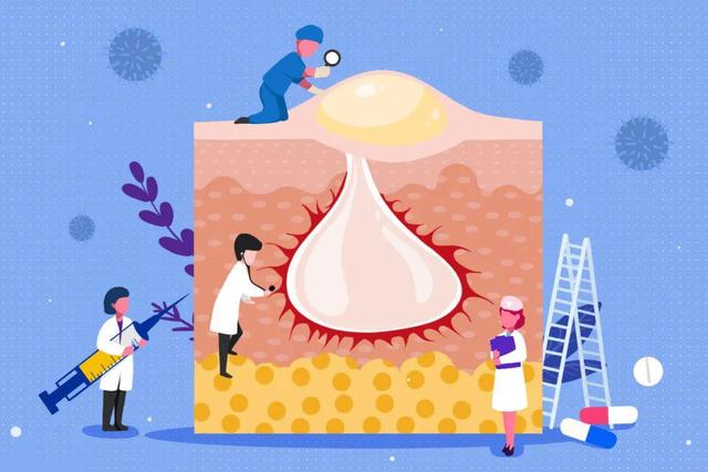 扁平疣角化过度色素增多