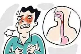 正确认识食管异物，吃饭卡住不要慌图片