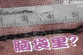 女大学生吃药调理月经致颅内血栓，药物中有这类物质一定要注意图片