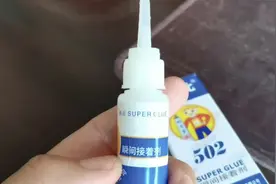 8岁男孩眼睛溅入502胶水，妈妈一番操作结果粘得更紧了图片