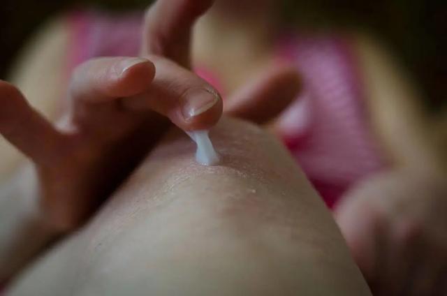 鸡皮肤要去角质嘛