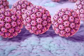 女性警惕这个癌！46岁女子同房后接触性出血1个月图片