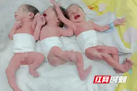 三胞胎在湖南省妇幼保健院平安降生图片