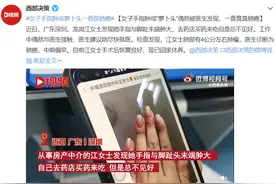 手指变粗，一查竟是肺癌！出现这些症状要小心了……图片