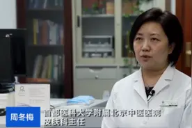 头发爱出油或是因为湿气重！如何让头发告别爱出油？这些调理小技巧学起来→图片