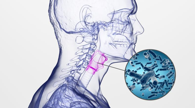 扁桃体角化症针灸
