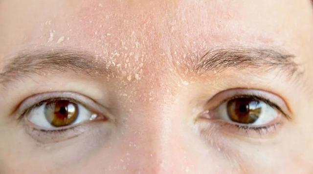 干纹,卡粉,起皮?护肤方法该注意了