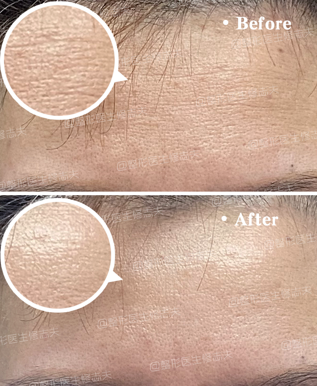 干纹,卡粉,起皮?护肤方法该注意了