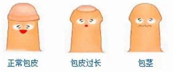 身体乳可以涂在包皮上吗