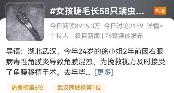 身上鸡皮疙瘩是螨虫那