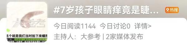 身上鸡皮疙瘩是螨虫那
