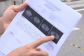 18岁少女腹中长出“毛发、眼球”，一查原来是它在作怪图片