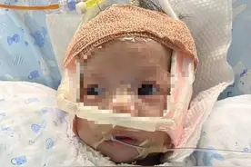 87天跨省转院的安安体温已恢复正常 稳定三天后进行心脏手术图片