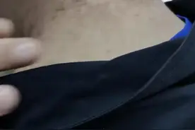 你知道有些肥胖人士的脖子“洗不干净”吗？医生：黑棘皮病，减重可缓解图片